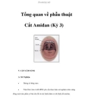 Tổng quan về phẫu thuật Cắt Amiđan (Kỳ 3)