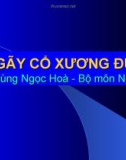 Bài giảng: GÃY CỔ XƯƠNG ĐÙI (Phùng Ngọc Hòa)