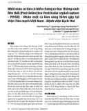 Nhồi máu cơ tim có biến chứng cơ học thủng vách liên thất (Post-Infarction Ventricular septal rupture - PIVSR) - Nhân một ca lâm sàng hiếm gặp tại Viện Tim mạch Việt Nam - Bệnh viện Bạch Mai