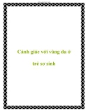 Cảnh giác với vàng da ở trẻ sơ sinh