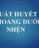 XUẤT HUYẾT KHOANG DƯỚI NHỆN