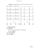 Sử dụng SAP2000 v9.03- P10