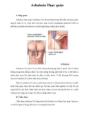 Giáo trình Achalasia Thực quản