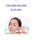 Cách chữa màu răng bị xỉn màu