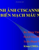 HÌNH ẢNH CTSCANNER TAI BIẾN MẠCH MÁU NÃO