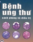 Cách phòng và điều trị bệnh ung thư: Phần 1