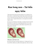 Rau bong non – Tai biến nguy hiểm