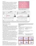 ABC OF INTERVENTIONAL CARDIOLOGY – PART 5