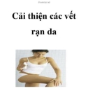 Cải thiện các vết rạn da