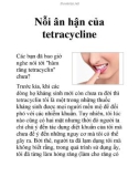 Nỗi ân hận của tetracycline