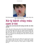 Xử lý bệnh chảy máu cam ở trẻ