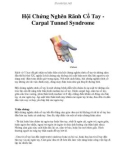 Hội Chứng Nghẽn Rãnh Cổ Tay Carpal Tunnel Syndrome