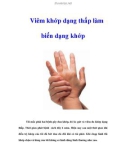 Viêm khớp dạng thấp làm biến dạng khớp