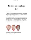 Tai biến khi vượt cạn (P3)