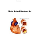 Chuẩn đoán nhồi máu cơ tim