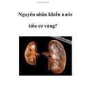 Nguyên nhân khiến nước tiểu có váng?